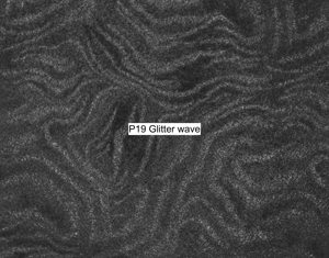 Nasenriemen-Leder_1050412IND-56